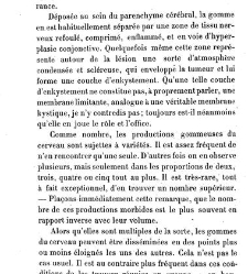 La syphilis du cerveau : leçons cliniques(1879) document 139801