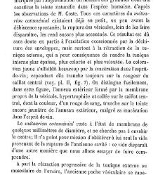 Trait&eacute; de la menstruation, ses rapports avec l'ovulation, la f&eacute;condation, l'hygi&egrave;ne de la pubert&eacute; et de l'&acirc;ge critique... par(1868) document 186160