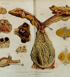 Trait&eacute; de la menstruation, ses rapports avec l'ovulation, la f&eacute;condation, l'hygi&egrave;ne de la pubert&eacute; et de l'&acirc;ge critique... par(1868) document 186688