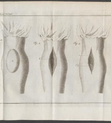 Verhandelingen van het Genootschap ter bevordering der heelkunde, te Amsterdam. : Part 1(1791) document 539153