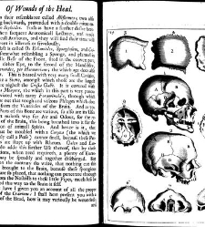 A compleat discourse of wounds, both in general and particular whereunto are added the severall fractures of the skull, with their variety of figures : as also a treatise of gunshot-wounds in general / collected and reduced into a new method by John Brown(1678) document 315311