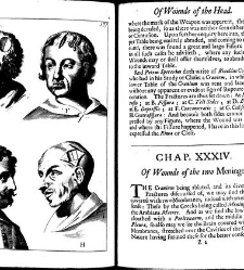 A compleat discourse of wounds, both in general and particular whereunto are added the severall fractures of the skull, with their variety of figures : as also a treatise of gunshot-wounds in general / collected and reduced into a new method by John Brown(1678) document 315337